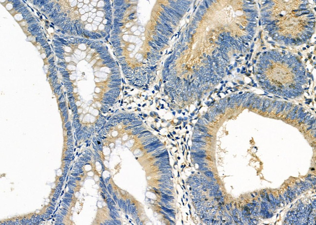 CYP2B6 Antibody in Immunohistochemistry (Paraffin) (IHC (P))