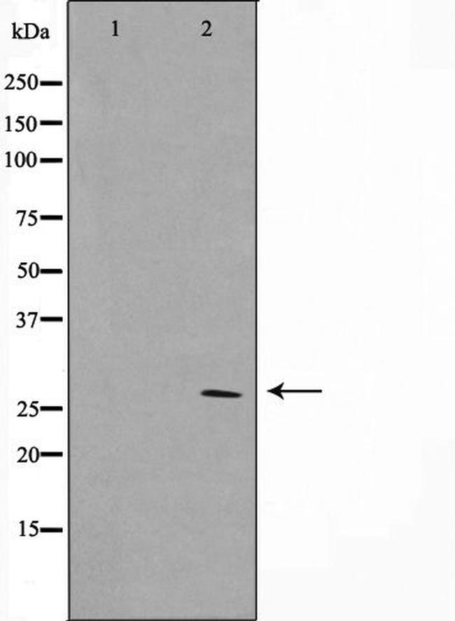 HOXD12 Antibody in Western Blot (WB)