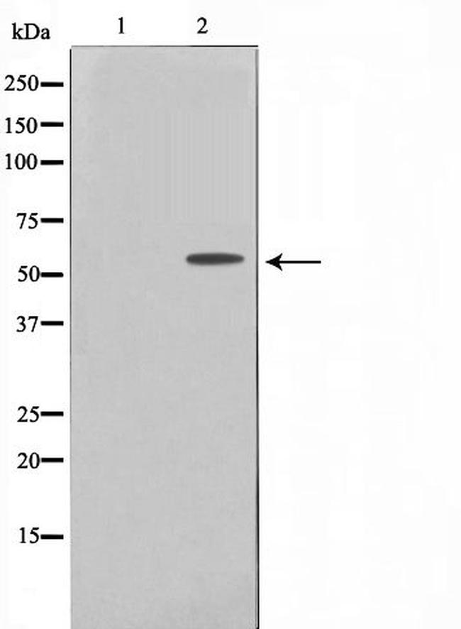 TBX22 Antibody in Western Blot (WB)