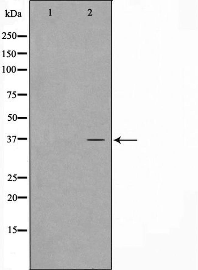 CARP Antibody in Western Blot (WB)