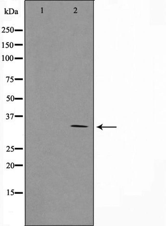 SURF1 Antibody in Western Blot (WB)