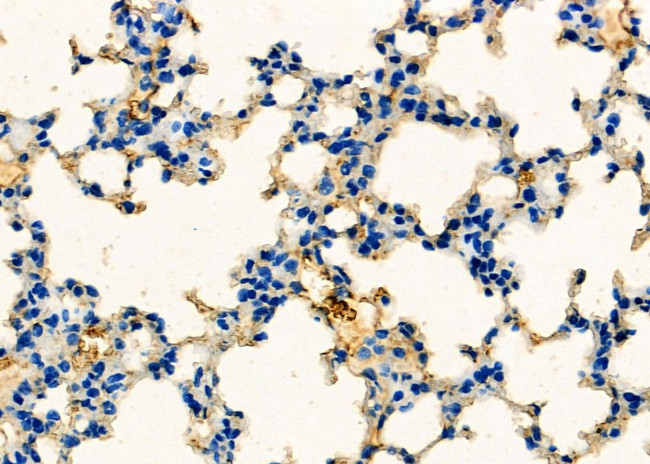 Epsin 2 Antibody in Immunohistochemistry (Paraffin) (IHC (P))