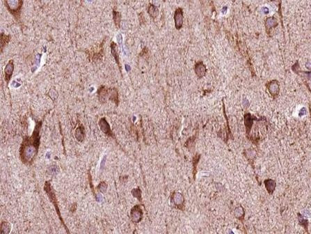 ZNF287 Antibody in Immunohistochemistry (Paraffin) (IHC (P))