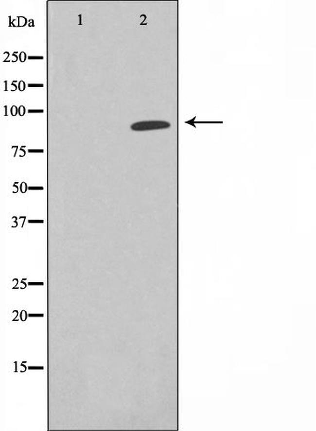 Epsin 1 Antibody in Western Blot (WB)