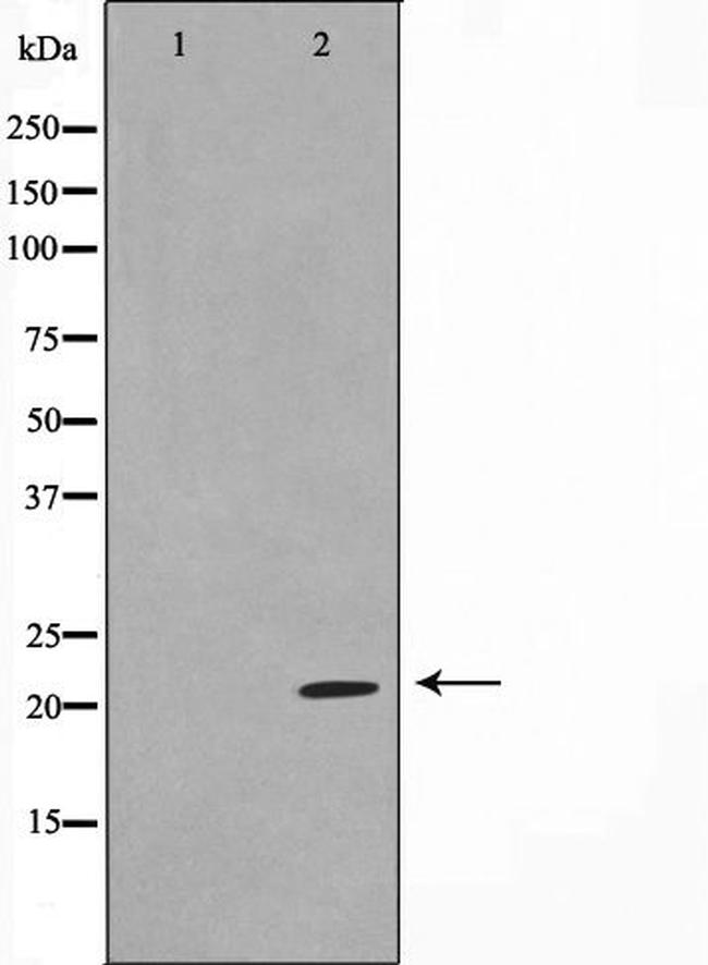 TPD52L2 Antibody in Western Blot (WB)