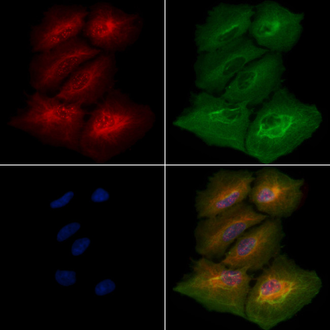TTC23 Antibody in Immunocytochemistry (ICC/IF)