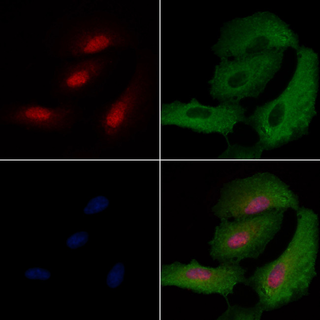 SIX6 Antibody in Immunocytochemistry (ICC/IF)