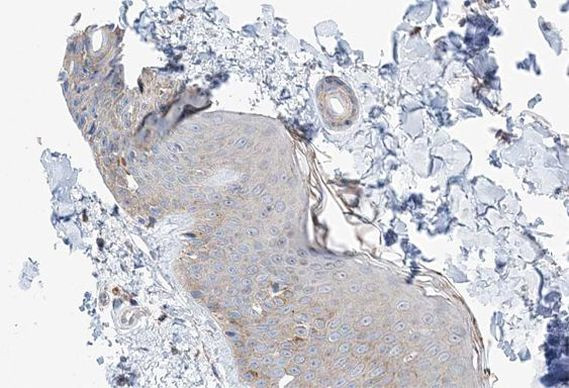 MAST4 Antibody in Immunohistochemistry (Paraffin) (IHC (P))