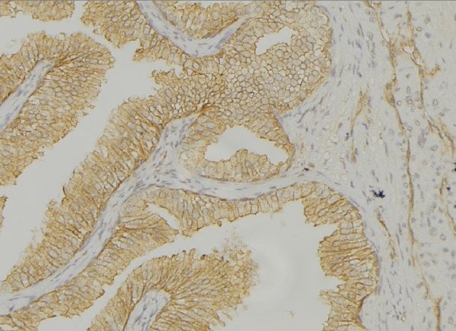 Cytokeratin 14/16 Antibody in Immunohistochemistry (Paraffin) (IHC (P))