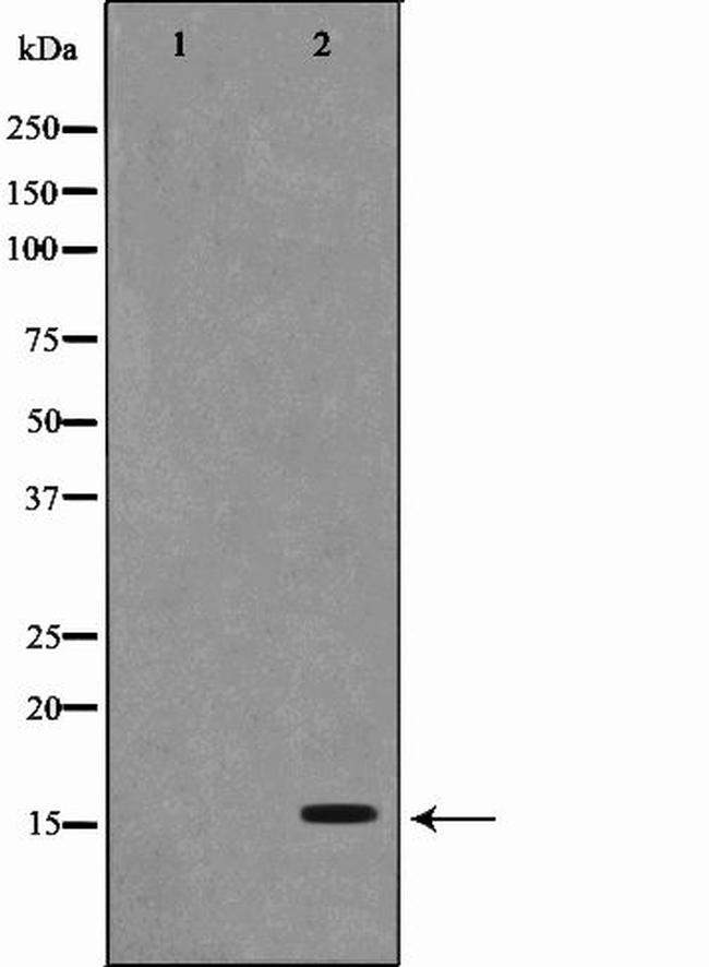 PFDN1 Antibody in Western Blot (WB)