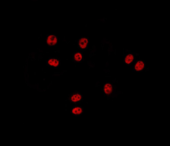 ZNF148 Antibody in Immunocytochemistry (ICC/IF)
