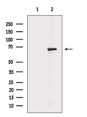 Acetyl-NFkB p65 (Lys310) Antibody in Western Blot (WB)