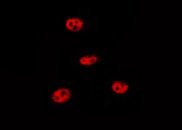 Phospho-p53 (Ser9) Antibody in Immunocytochemistry (ICC/IF)