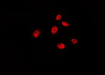 Phospho-p53 (Ser315) Antibody in Immunocytochemistry (ICC/IF)