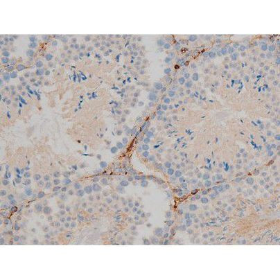 Phospho-BCL-2 (Ser70) Antibody in Immunohistochemistry (Paraffin) (IHC (P))