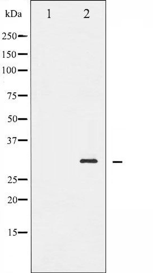 Phospho-BCL-2 (Ser70) Antibody in Western Blot (WB)