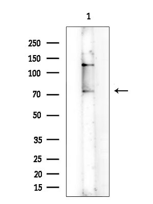Phospho-PKR (Thr446) Antibody in Western Blot (WB)