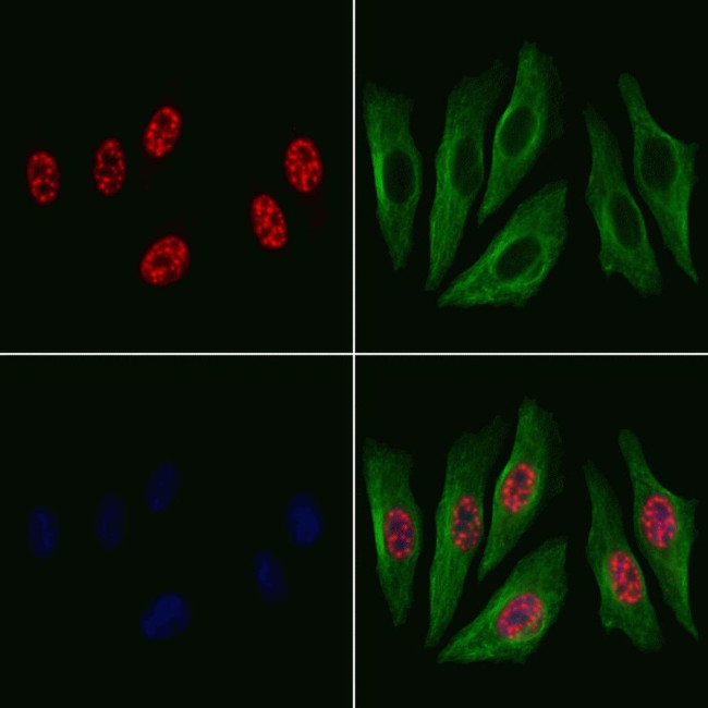Phospho-Cyclin E (Thr395) Antibody in Immunocytochemistry (ICC/IF)
