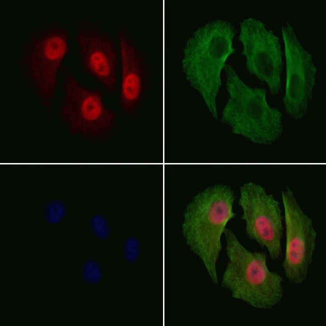 Phospho-p27 Kip1 (Thr198) Antibody in Immunocytochemistry (ICC/IF)