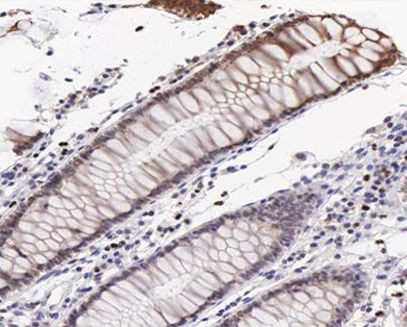 Phospho-VASP (Ser239) Antibody in Immunohistochemistry (Paraffin) (IHC (P))