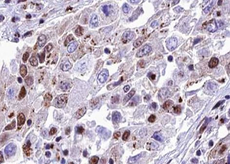 Phospho-NFkB p65 (Ser468) Antibody in Immunohistochemistry (Paraffin) (IHC (P))