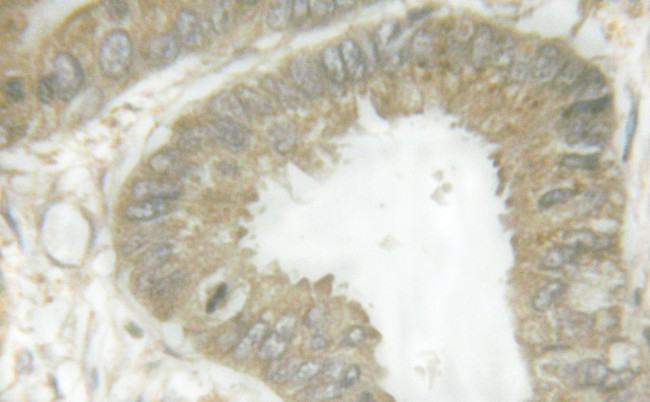 Phospho-HSL (Ser855, Ser554) Antibody in Immunohistochemistry (Paraffin) (IHC (P))