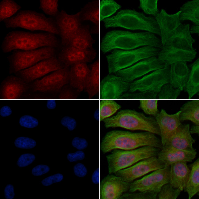 Phospho-PKC delta (Ser645) Antibody in Immunocytochemistry (ICC/IF)