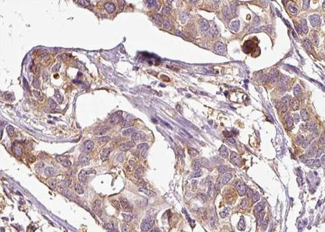 Phospho-ASK1 (Ser83) Antibody in Immunohistochemistry (Paraffin) (IHC (P))