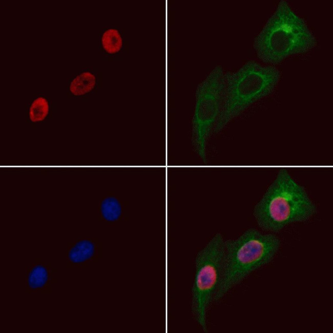 RING1 Antibody in Immunocytochemistry (ICC/IF)