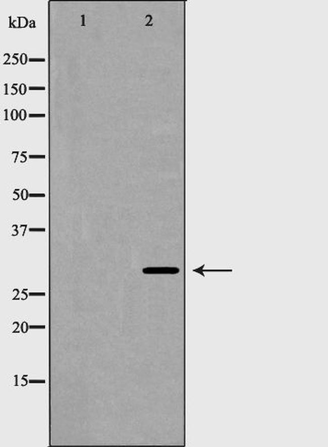 HOXB5 Antibody in Western Blot (WB)