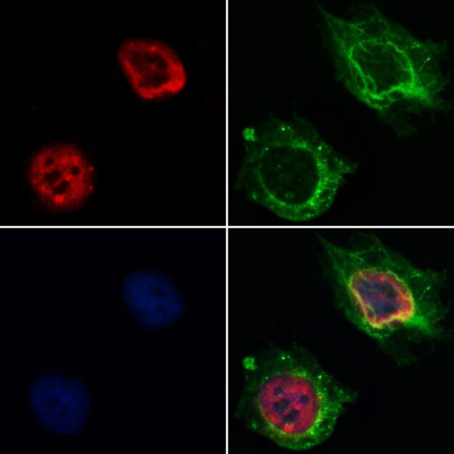 hnRNP H1 Antibody in Immunocytochemistry (ICC/IF)