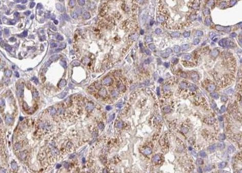 EphA3 Antibody in Immunohistochemistry (Paraffin) (IHC (P))