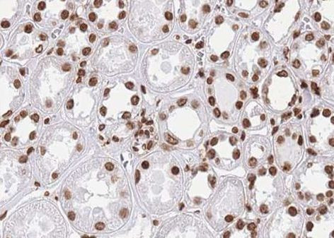 hnRNP L Antibody in Immunohistochemistry (Paraffin) (IHC (P))