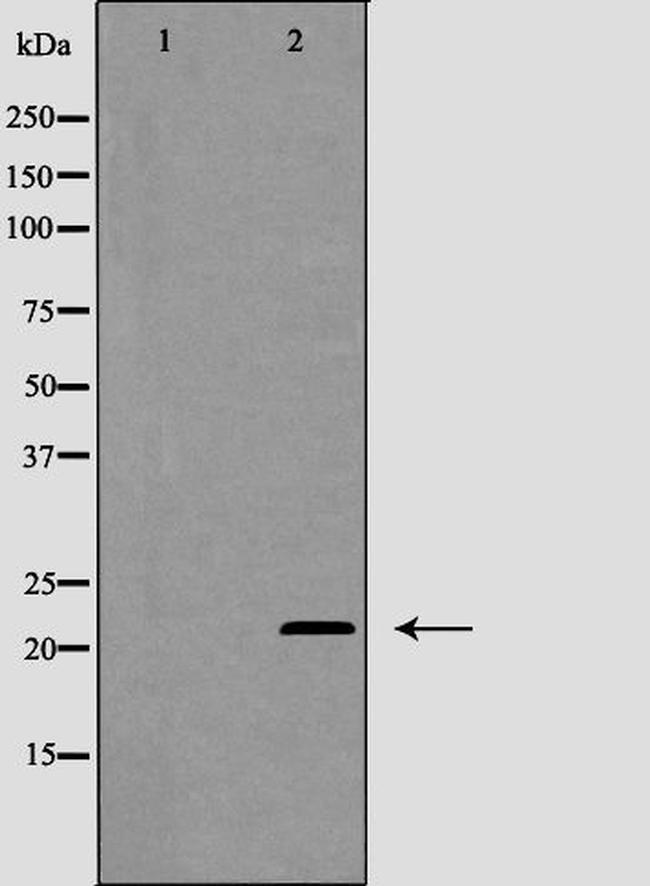 MGMT Antibody in Western Blot (WB)