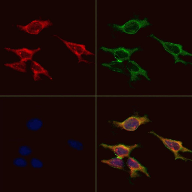 GPR91 Antibody in Immunocytochemistry (ICC/IF)