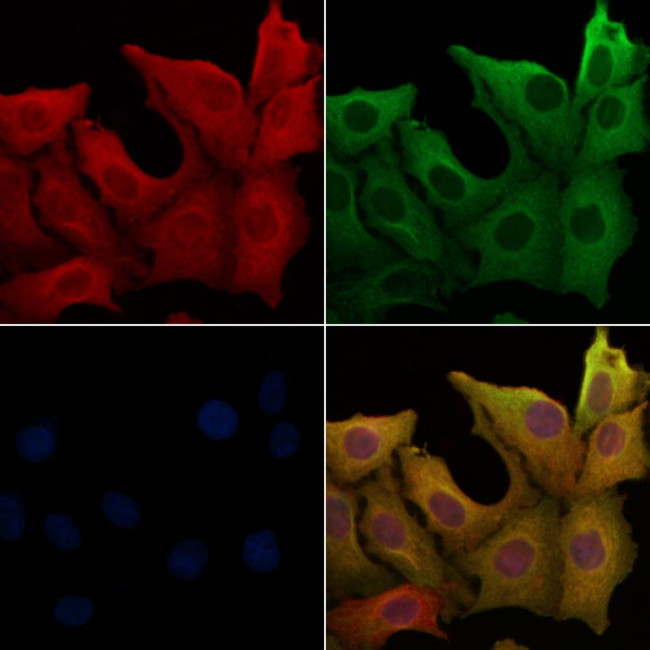 Gastrin Antibody in Immunocytochemistry (ICC/IF)