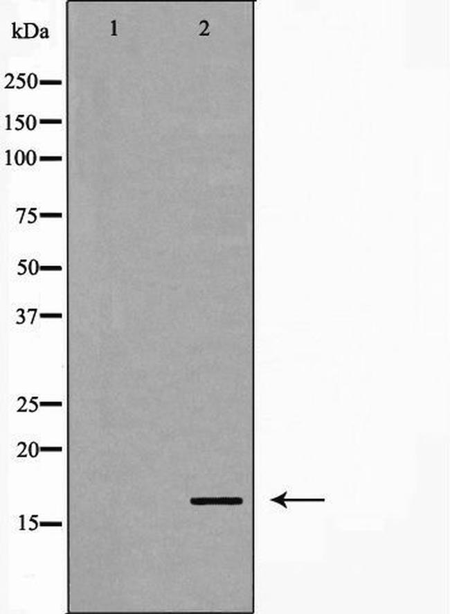 Phospho-Stathmin 1 (Ser25) Antibody in Western Blot (WB)