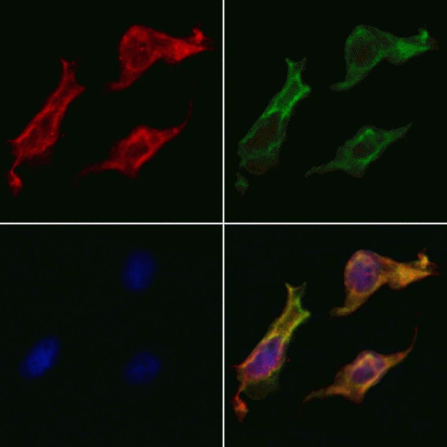 Cytokeratin 16 Antibody in Immunocytochemistry (ICC/IF)