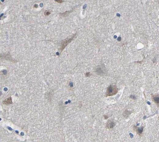 hnRNP C1/C2 Antibody in Immunohistochemistry (Paraffin) (IHC (P))