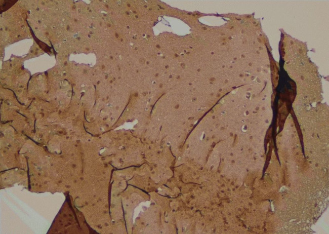 PLCG1 Antibody in Immunohistochemistry (Paraffin) (IHC (P))