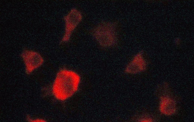 EpoR Antibody in Immunocytochemistry (ICC/IF)