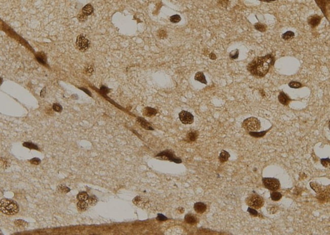 CDC25C Antibody in Immunohistochemistry (Paraffin) (IHC (P))