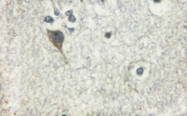 alpha Adducin Antibody in Immunohistochemistry (Paraffin) (IHC (P))