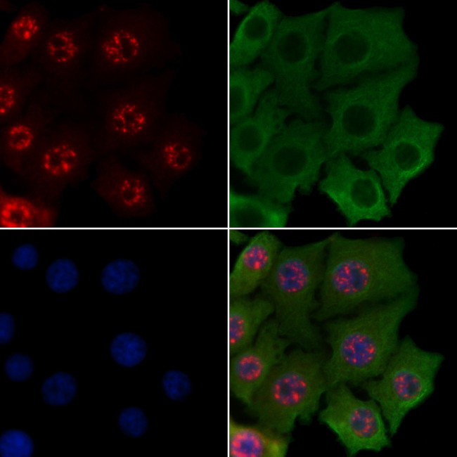 Ataxin 1 Antibody in Immunocytochemistry (ICC/IF)