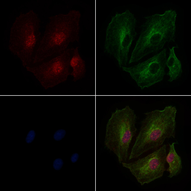 Histone H3 Antibody in Immunocytochemistry (ICC/IF)