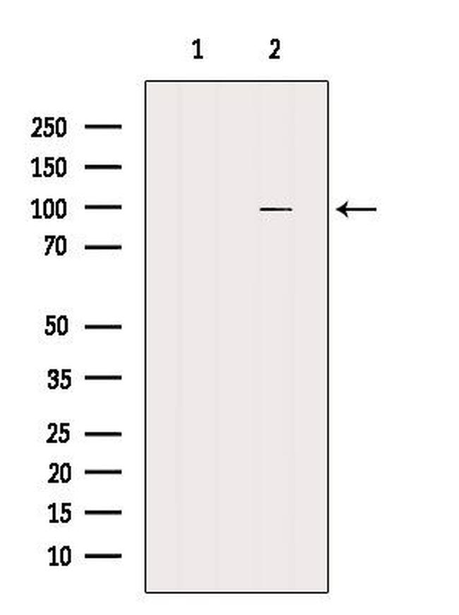 Caldesmon Antibody in Western Blot (WB)