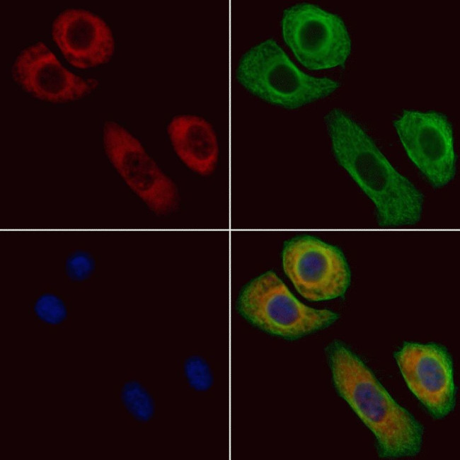 NFATC3 Antibody in Immunocytochemistry (ICC/IF)