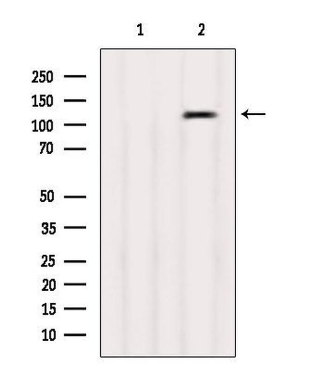 PKD1/2/3/PKC mu Antibody in Western Blot (WB)