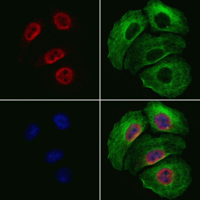 TRAP220 Antibody in Immunocytochemistry (ICC/IF)