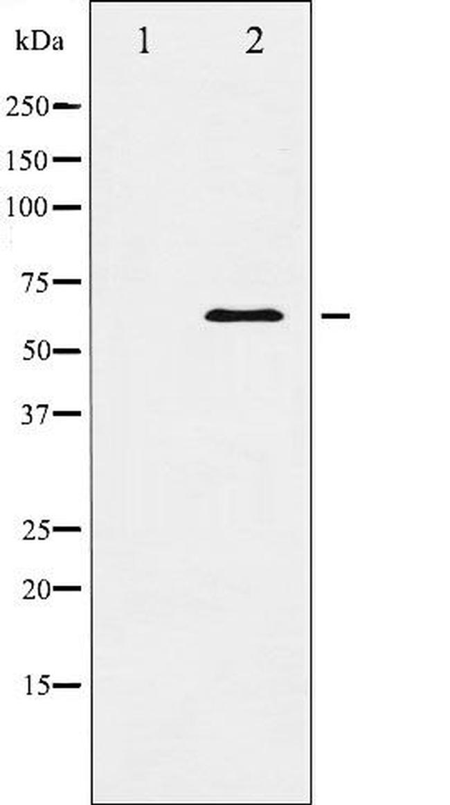 DOK1 Antibody in Western Blot (WB)